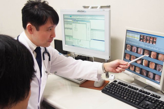 大腸内視鏡検査